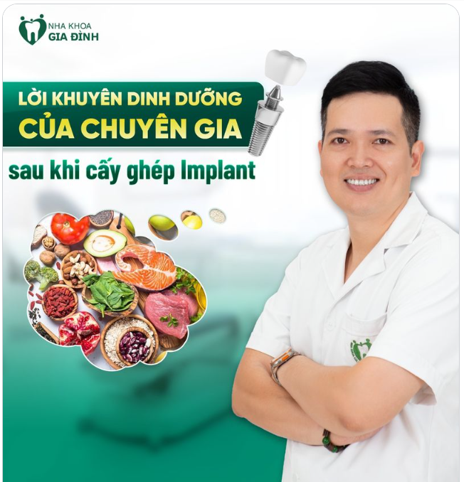 LỜI KHUYÊN DINH DƯỠNG CỦA CHUYÊN GIA SAU CẤY GHÉP IMPLANT