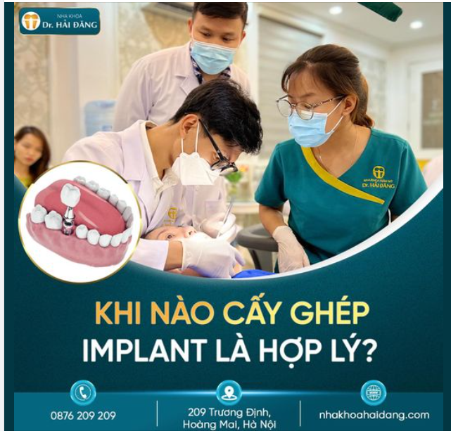 KHI NÀO CẤY GHÉP IMPLANT LÀ HỢP LÝ