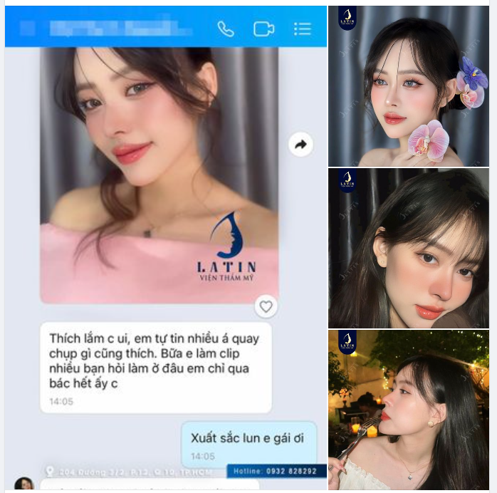 Nâng cấp từ sụn thường lên sụn SURGIFORM là một trải nghiệm tuyệt vời