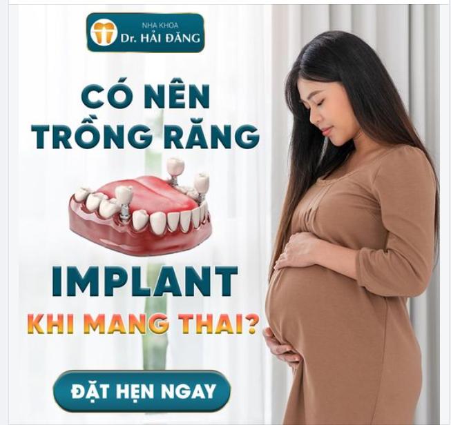 CÓ NÊN TRỒNG RĂNG IMPLANT KHI MANG THAI