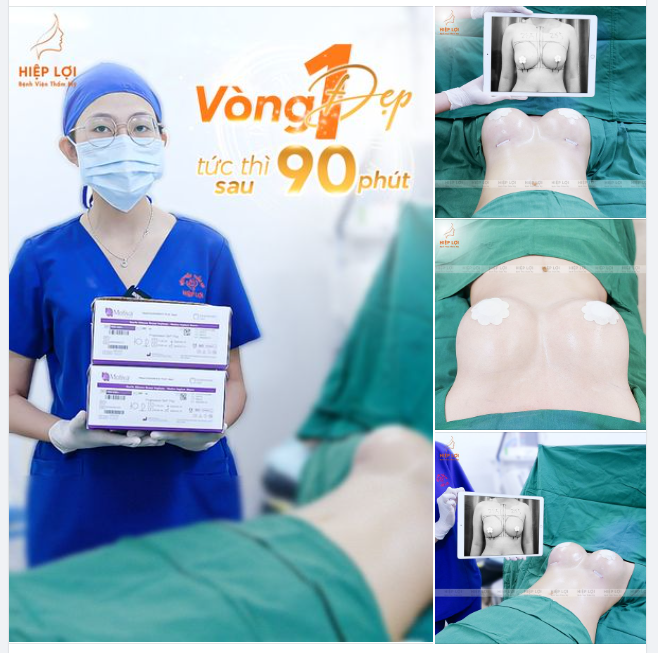 VÒNG 1 CĂNG TRÒN CHỈ SAU 90P  ƯU ĐÃI LỚN CHỈ 39TR CÙNG DÒNG TÚI NGỰC CAO CẤP