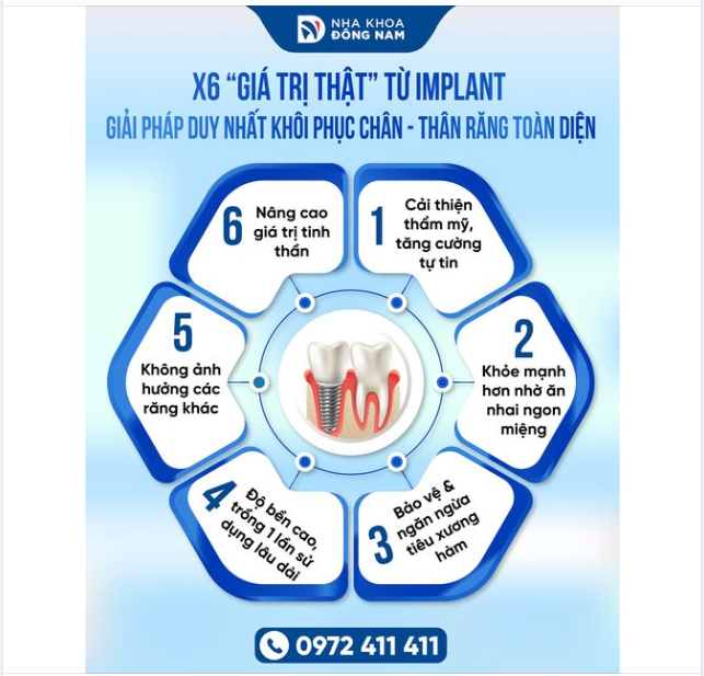 Cấy ghép Implant :Giá trị nhiều hơn giá cả