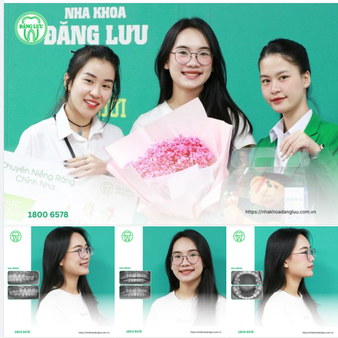 CƯỜI RẠNG RỠ THEO CÁCH CỦA CHÍNH MÌNH