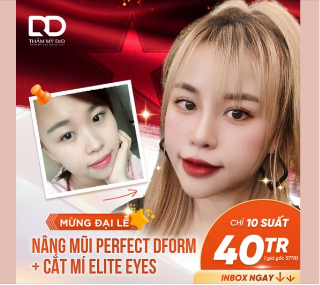 Mừng đại lễ làm combo mũi - mí nhận ngay ưu đãi siêu hời