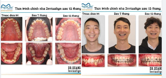 Khách hàng: N - P- Duy (26 tuổi)