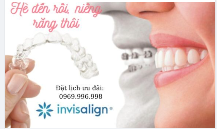 MÙA HÈ ĐẾN RỒI….NIỀNG RĂNG THÔI !!!