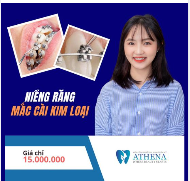 Tại sao mắc cài kim loại chưa bao giờ lỗi thời?
