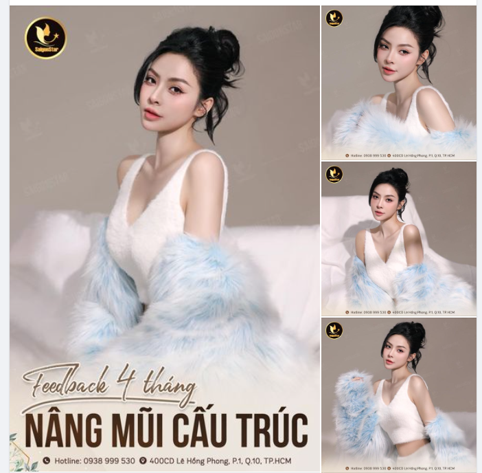 Bạn nào còn đang băn khoăn có nên đi nâng mũi không thì xem xong feedback này hãy nhanh tay đặt lịch để Bác sĩ Hoạt thiết kế cho bạn 1 dáng mũi sang chảnh, cuốn hút mọi ánh nhìn nhé!