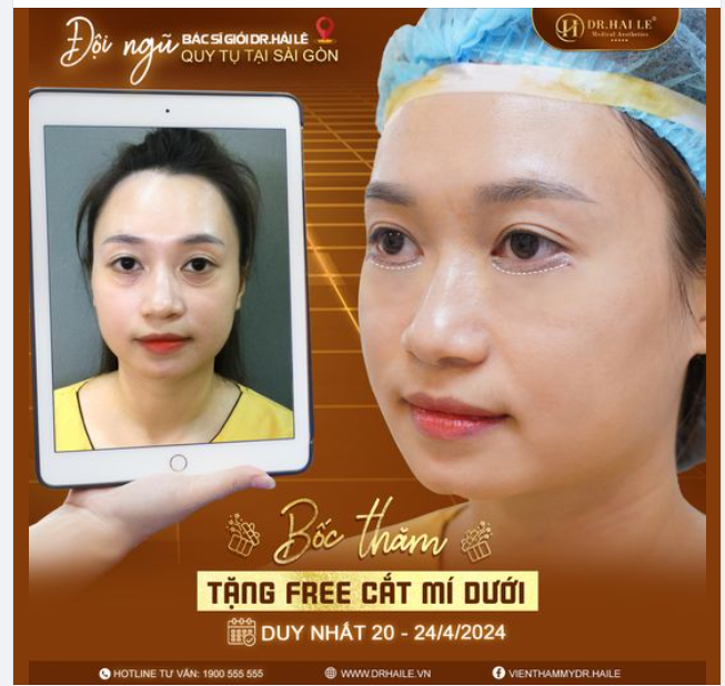 Thời gian đội ngũ bác sĩ giỏi Dr.Hải Lê công tác Sài Gòn không còn nhiều, chị em nhanh chân đến Dr.Hải Lê cơ sở HCM cắt mí dưới để nhận loạt ưu đãi khủng nha!