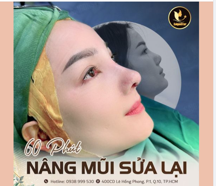 60 PHÚT THAY ĐỔI DÁNG MŨI NHỜ NÂNG MŨI CẤU TRÚC DR. HOẠT