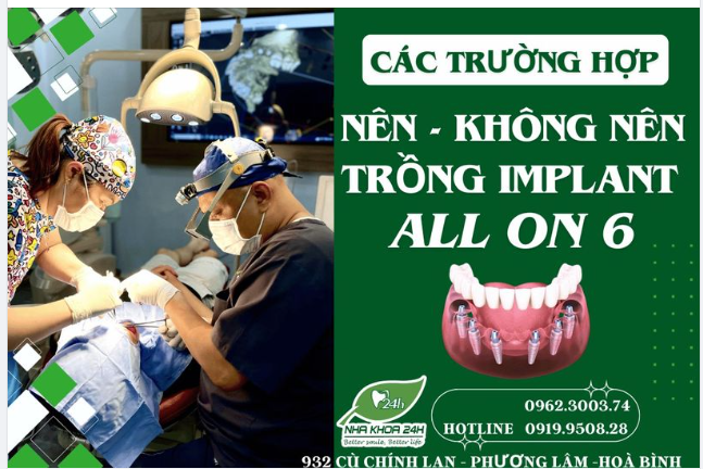 Nên hay không nên Trồng răng Implant All on