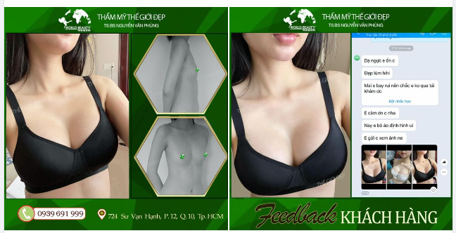 Từ Vòng 1 nhỏ, lép cũng hóa ĐẪY ĐÀ nhờ túi đ.ộn ng.ực cao cấp Nanochip Ergonomix!