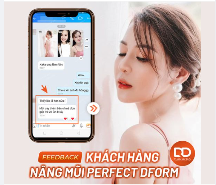 FEEDBACK MŨI XINH SAU KHI THỰC HIỆN DỊCH VỤ NÂNG MŨI PERFECT DFORM TẠI DRD.