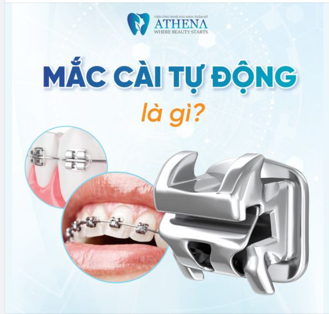MẮC CÀI TỰ ĐỘNG LÀ GÌ?