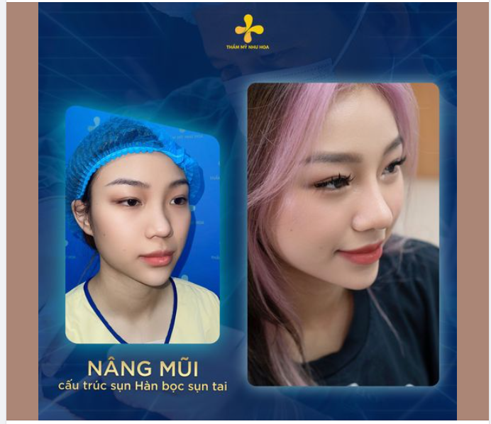 Không uổng công ngồi máy bay 13 tiếng về Việt Nam làm đẹp, Hà Vi đã tự tin quay lại Anh tiếp tục việc học tập.