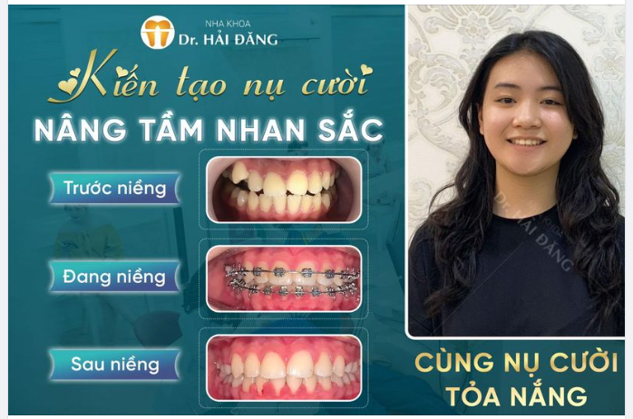 Kiến tạo nụ cười nâng tầm nhan sắc