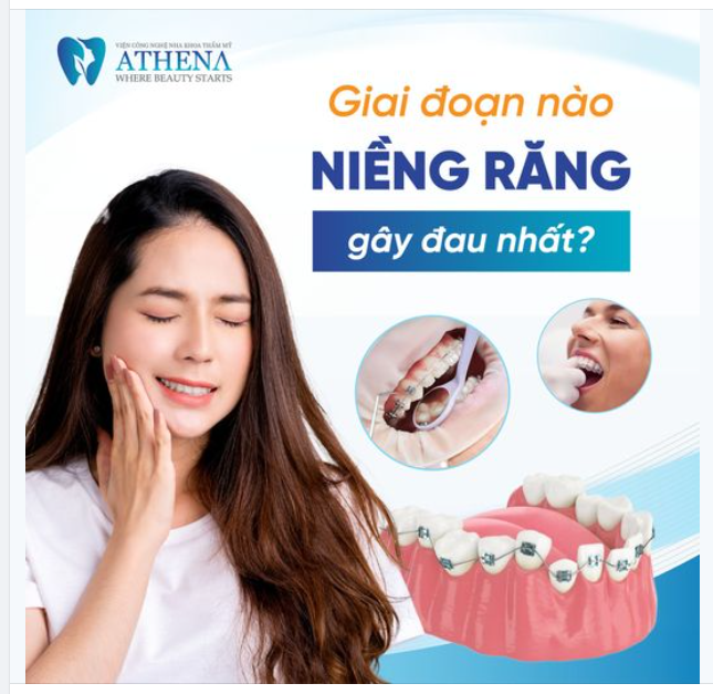 NIỀNG RĂNG ĐAU NHẤT LÀ LÚC NÀO?