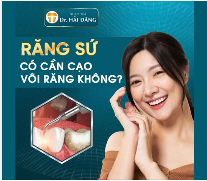 BỌC RĂNG SỨ CÓ CẦN CẠO VÔI RĂNG KHÔNG