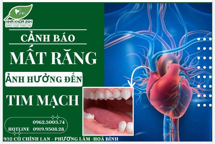 CẢNH BÁO: TIỀM ẨN NGUY CƠ MẮC BỆNH TIM MẠCH DO MẤT RĂNG