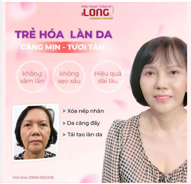 CĂNG DA MẶT ƯU ĐÃI LÊN ĐẾN 9 TRIỆU ĐỒNG