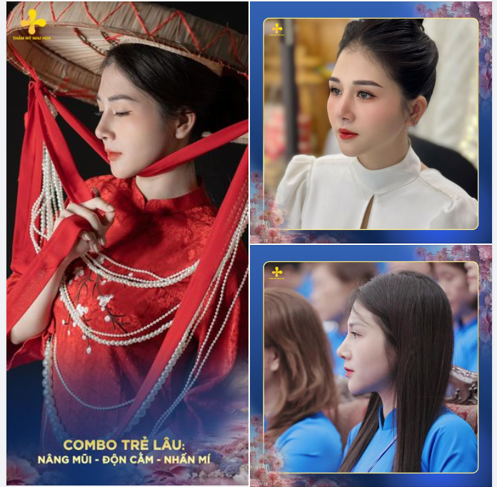 MŨI CAO - MÍ NÉT - CẰM THON