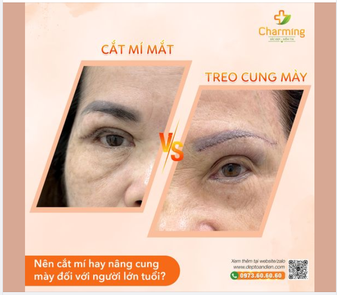 NGƯỜI LỚN TUỔI NÊN CẮT MÍ HAY NÂNG CUNG MÀY?