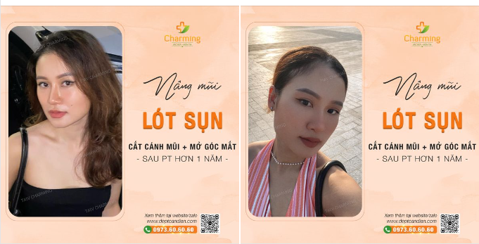 Người đâu mà đẹp lung linh. Làm Charming cứ ngắm nhìn không thôi
