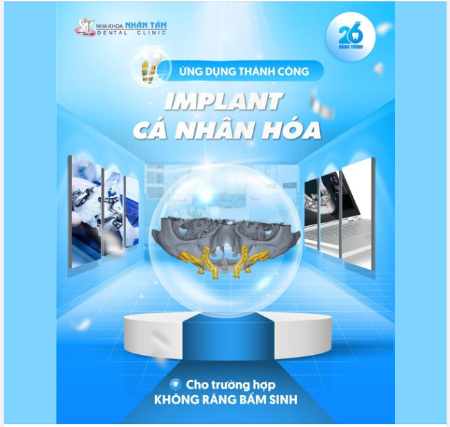 Nha khoa Nhân Tâm ứng dụng thành công Implant cá nhân hóa tại Việt Nam