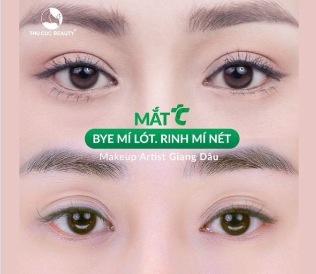 Hô biến đôi mắt nhiều khuyết điểm thành 2 mí sắc nét