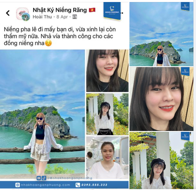 Feedback đáng yêu của cô gái niềng răng Ngân Phượng