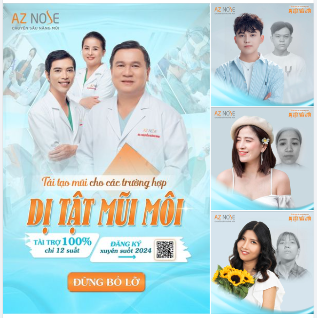 Cơ hội cho các trường hợp Dị Tật Mũi Môi