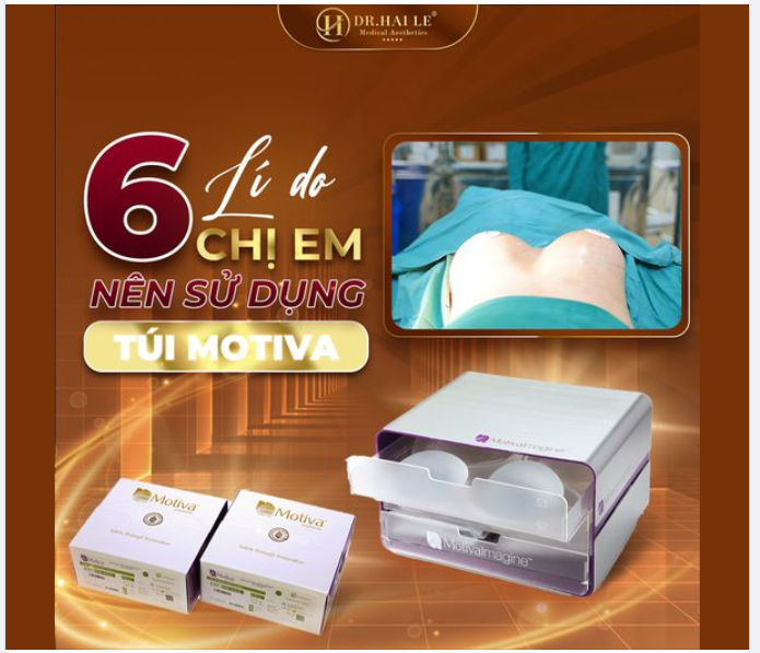 Top 6 lí do chị em nên lựa chọn túi Motiva