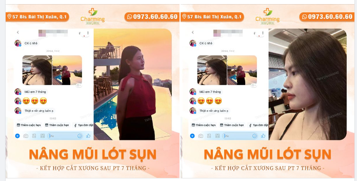Khách đã nói ưng thì Charming còn nghĩ gì khác được nữa