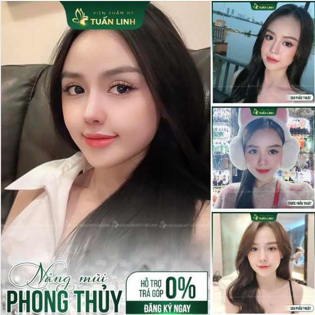 MŨI ĐẸP TỰ NHIÊN - HỢP PHONG THỦY...!