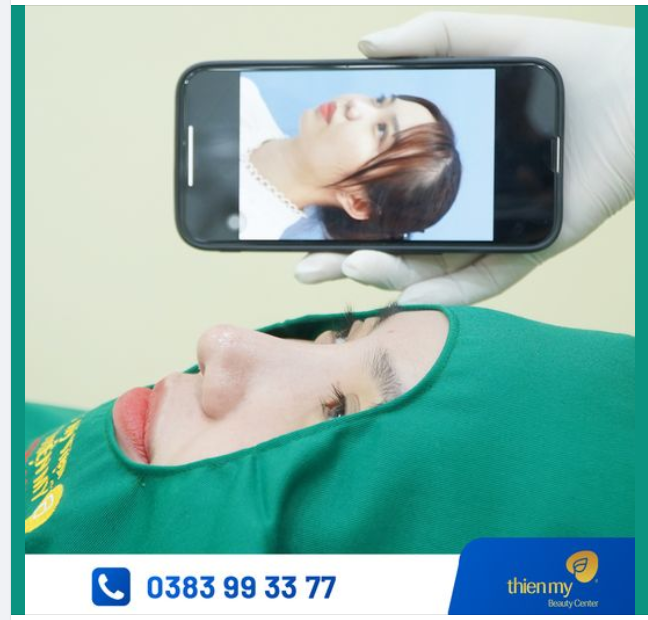 Màn lột xác cùng nâng mũi khiến cho gương mặt Chị khách hàng xinh xắn nay lại càng trở nên sắc nét và hoàn hảo