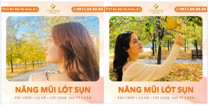 Sao mà Charming mê chữ ê kéo dài với chiếc mũi đã nâng mũi lót sụn, cà gồ, thu chóp và cắt cánh mũi của nàng khách quá đi.