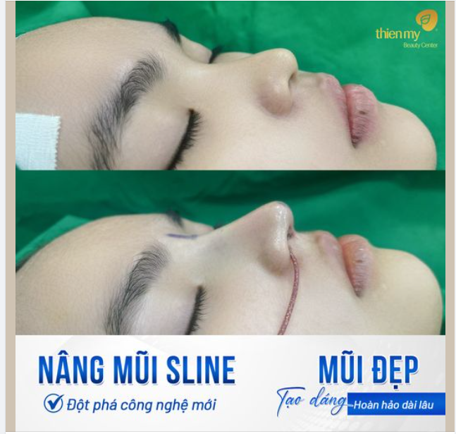PKCK Thiện Mỹ không chỉ là một địa điểm làm đẹp mà còn mang đến cho Quý khách hàng sự tận tâm từ bác sĩ Nguyễn Hữu Thiện.