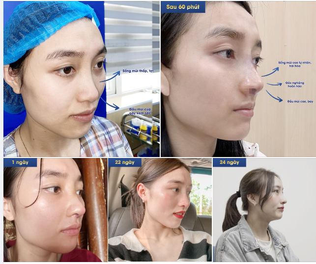 HÀNH TRÌNH NGHÌN DẶM CỦA THỰC TẬP SINH VIỆT NAM BAY TỪ NHẬT VỀ ĐÂY CHỈ ĐỂ…?