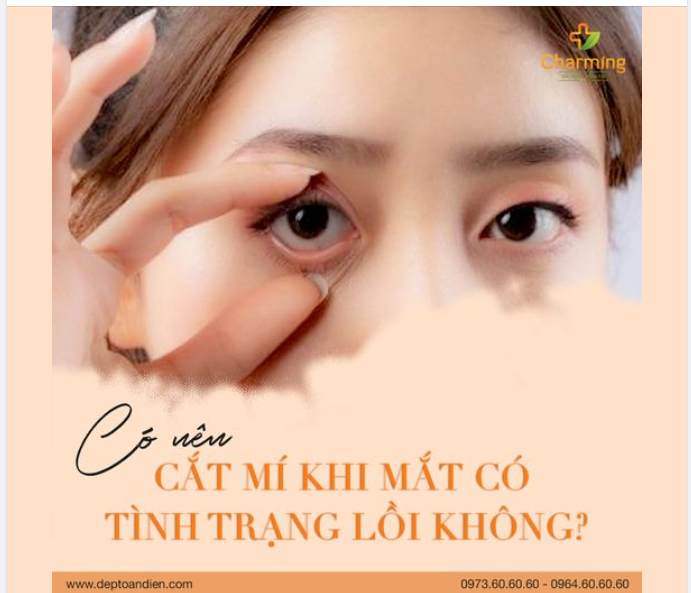 MẮT LỒI CÓ CẮT MÍ ĐƯỢC KHÔNG?