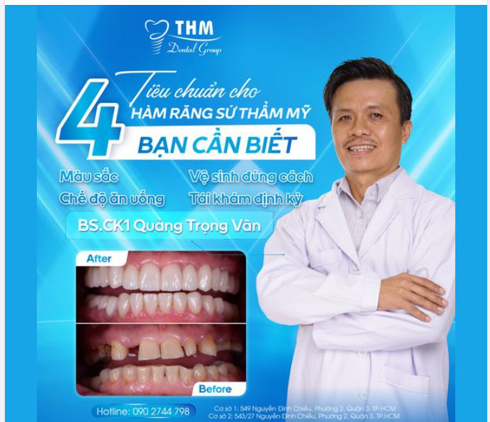 4 TIÊU CHUẨN CHO HÀM RĂNG SỨ THẨM MỸ BẠN CẦN BIẾT
