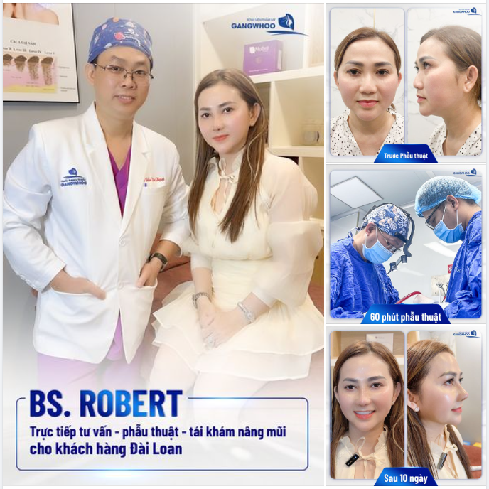 Bs .Robert mang đến dáng mũi đẹp - tự nhiên cho khách hàng Đài Loan