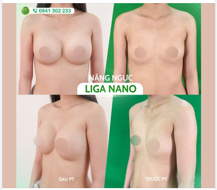 THAY ĐỔI SỐ ĐO VÒNG 1 TRONG TÍCH TẮC