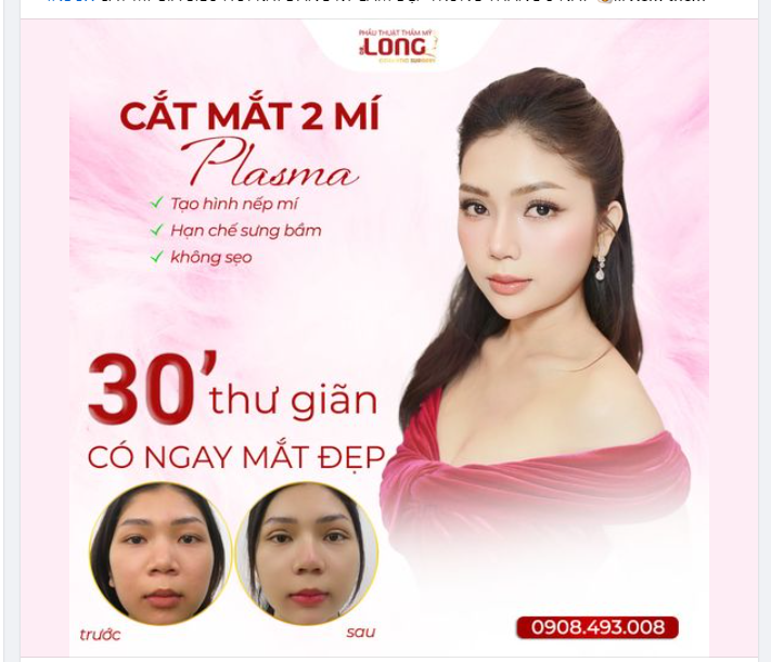 CHÚNG TA CỦA HIỆN TẠI SAU KHI CẮT MÍ MẮT TẠI PTTM BÁC SĨ LONG