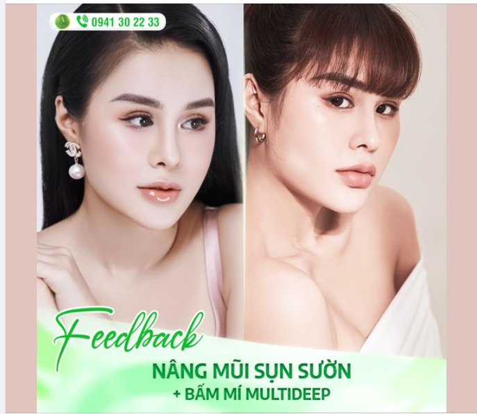 COMBO MŨI, MÍ - THAY ĐỔI TOÀN DIỆN GƯƠNG MẶT