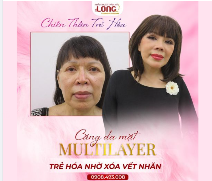 CỐC…CỐC…CỐC…AI ĐANG GÕ CỬA? Lão hóa đã đến và gõ cửa nhà bạn đấy!