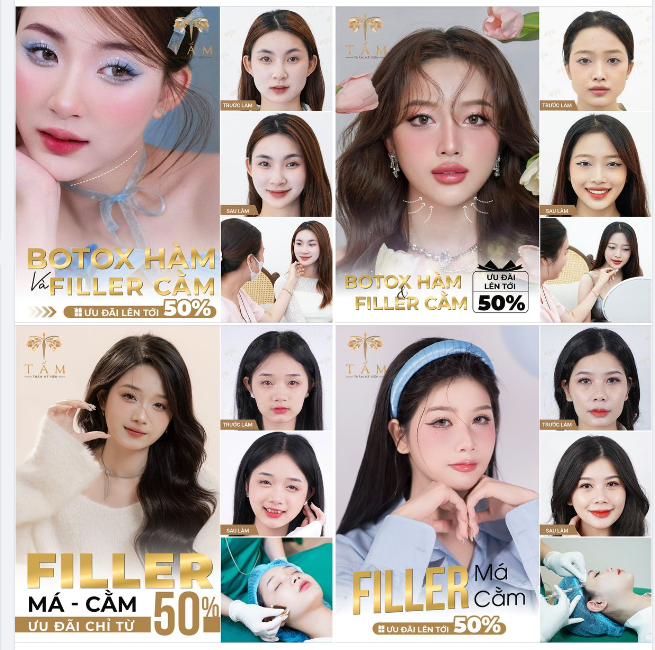 Trải nghiệm ngay bộ đôi thẩm mỹ đỉnh cao BOTOX THON GỌN HÀM và FILLER MÁ - CẰM hot nhất hiện nay tại Tấm