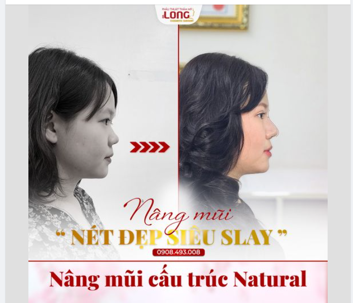 CÔ NÀNG 2K THAY ĐỔI NGOẠN MỤC SAU NÂNG MŨI