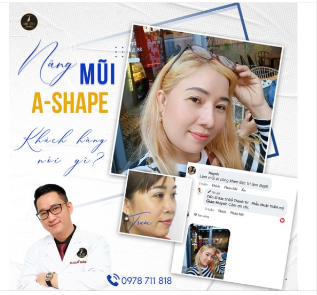 Dáng mũi độc quyền của  Dr Trí