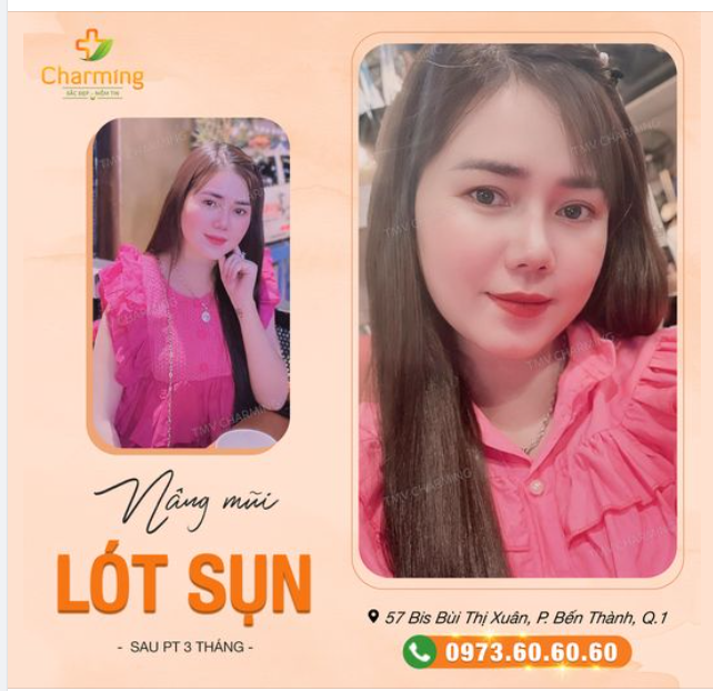 Nàng cười một nét thật duyên. Nghiêng nghiêng chiếc mũi đảo điên lòng người