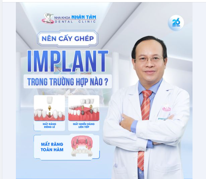 Nên cấy ghép Implant trong trường hợp nào?